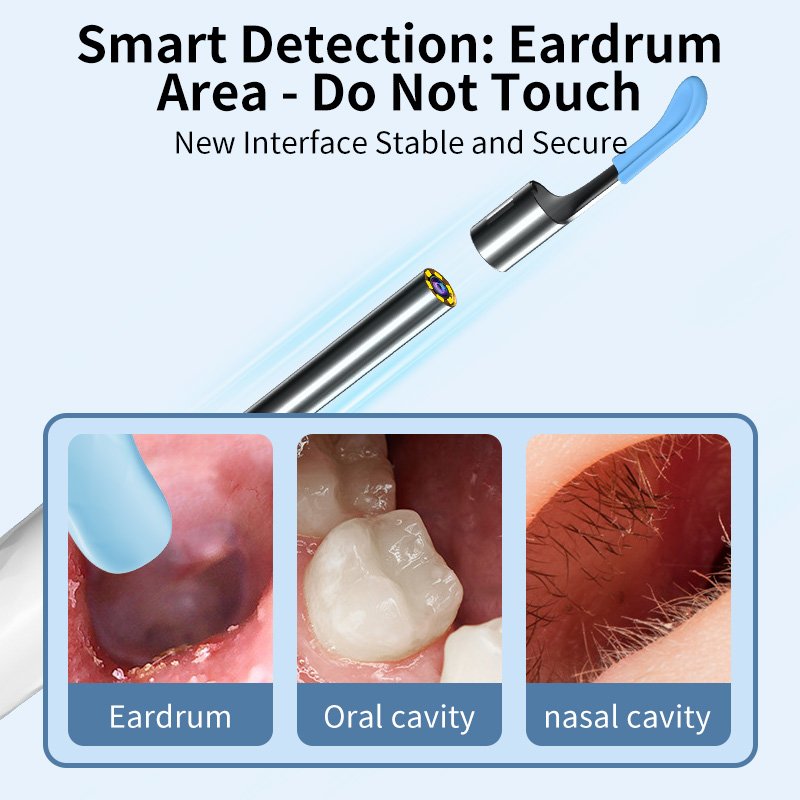 NonaEar™3-in-1 Smart Home Endoscope